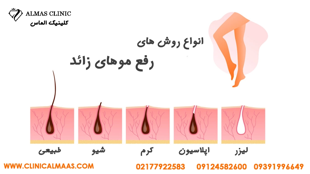 لیزر موهای زائد برای چه کسانی ضرر دارد؟