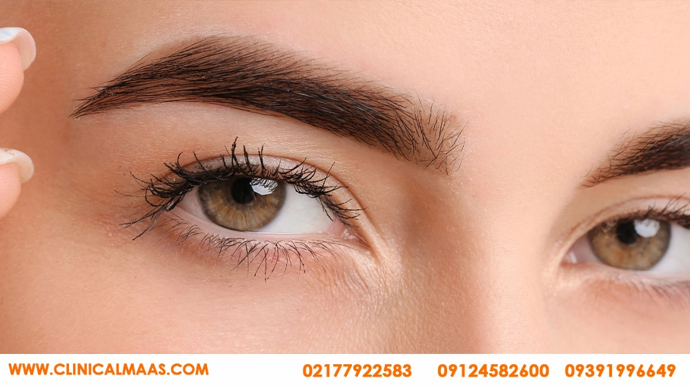 بهترین کلینیک تزریق بوتاکس ابرو در تهران