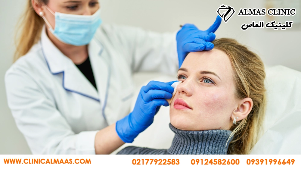 درمان جای جوش و اسکار