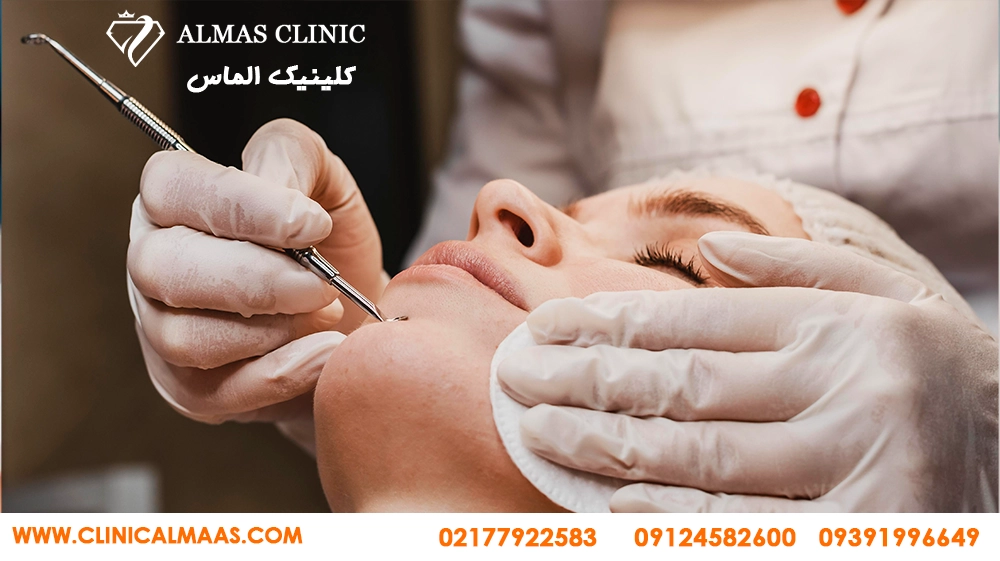 درمان جای جوش و اسکار