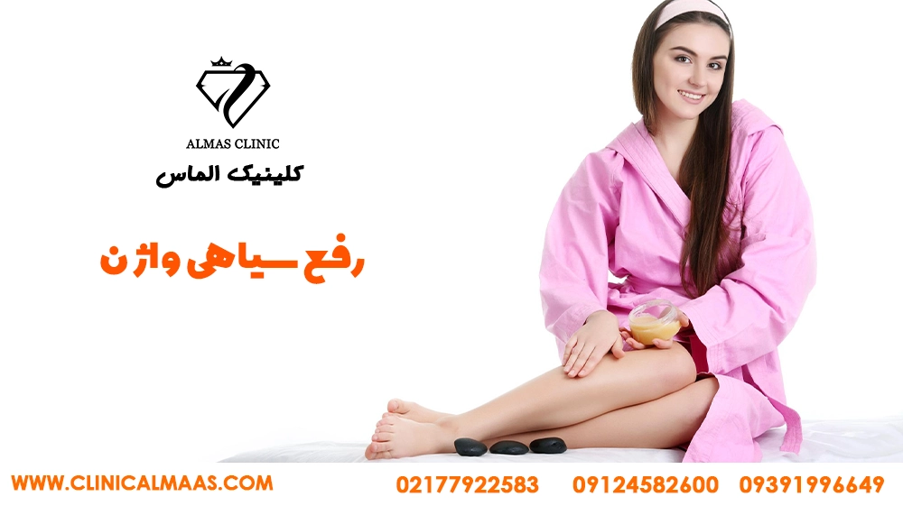 رفع تیرگی واژن با لیزر