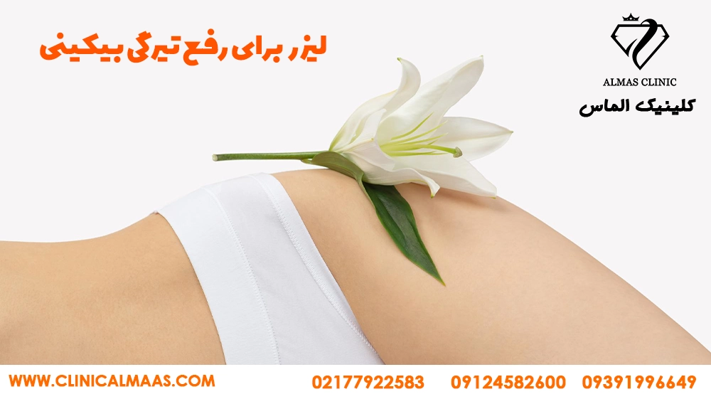 رفع تیرگی واژن با لیزر