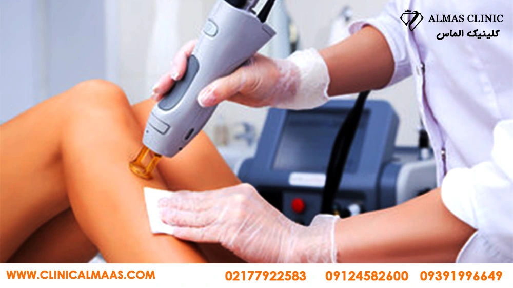 مرکز تخصصی لیزر موهای زائد با دستگاه الکس کندلا