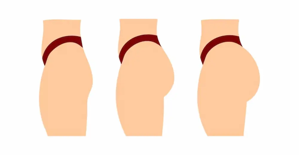 مرکز تخصصی تزریق فیلر باسن در شرق تهران