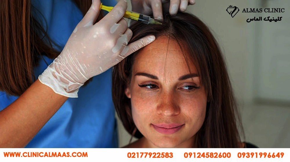 مزوتراپی برای درمان ریزش مو