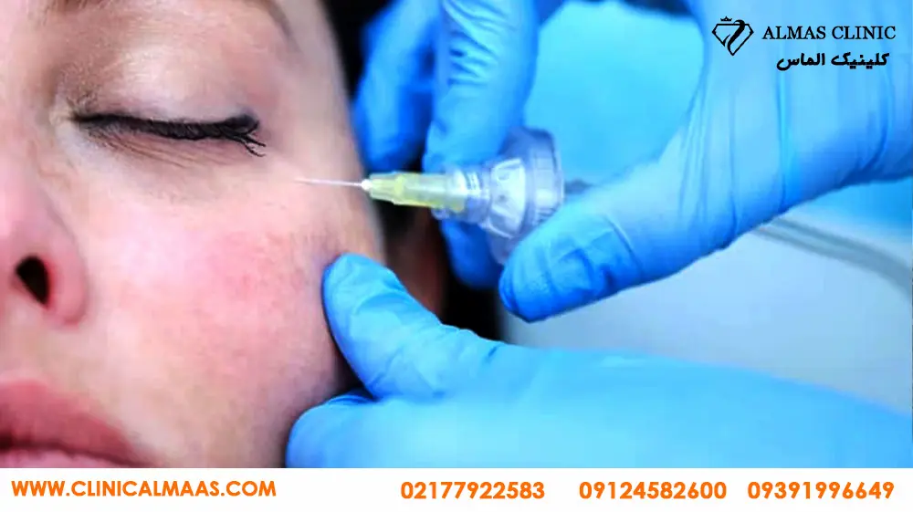 بهترین مرکز هایفوتراپی در تهران