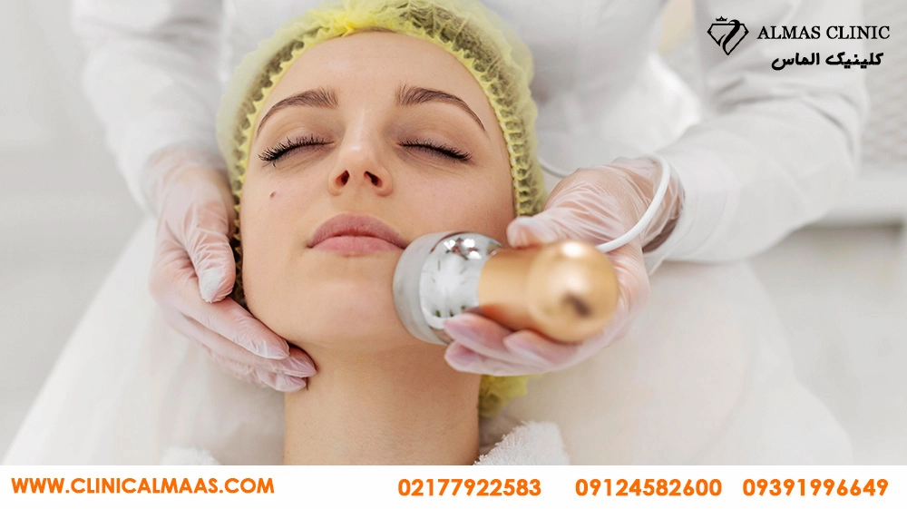 بهبود پوست با کربوکسی تراپی در تهران