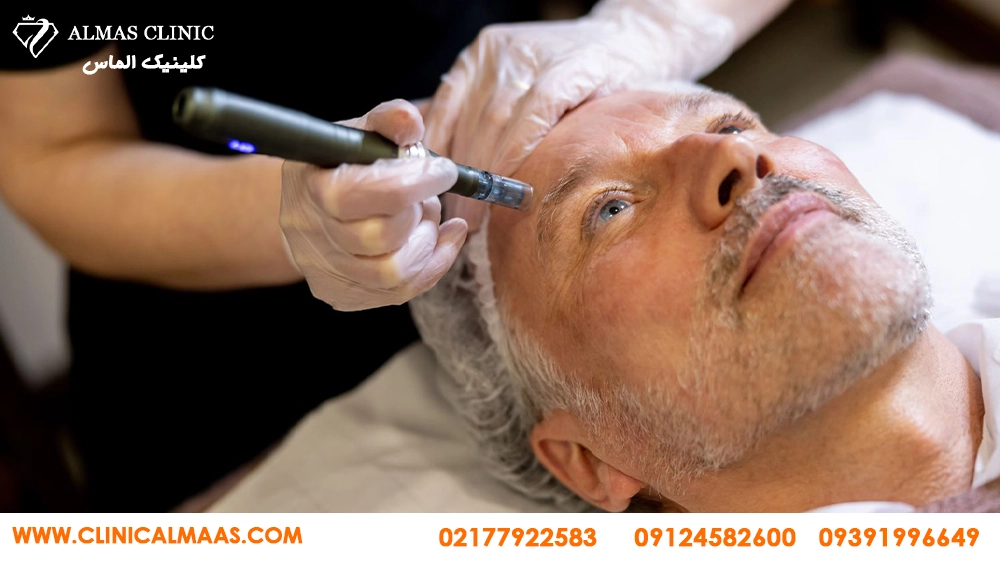 میکرونیدلینگ ترکیبی