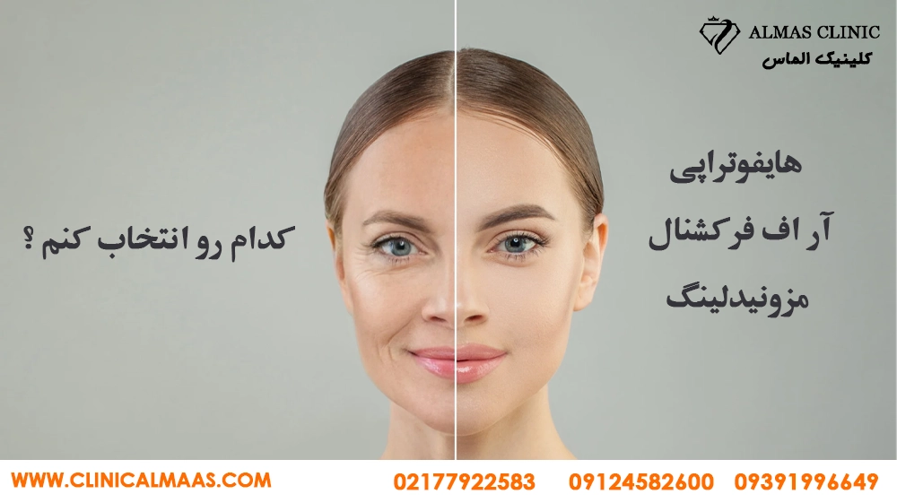 بین هایفوتراپی و آر اف فرکشنال و مزونیدلینگ کدوم رو انتخاب کنم