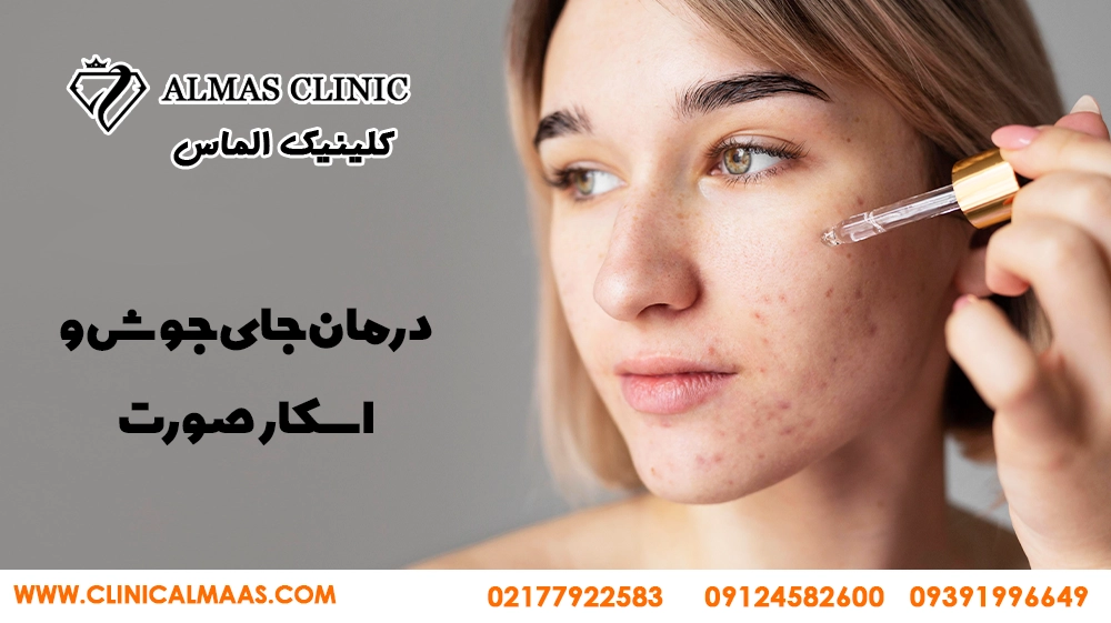 درمان جای جوش و اسکار