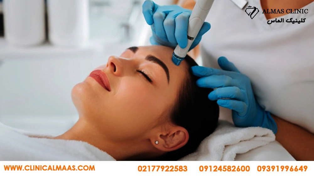 میکرودرم ابریژن برای لک صورت