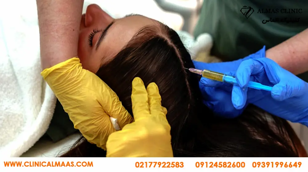 درمان ریزش مو به کمک مزوتراپی