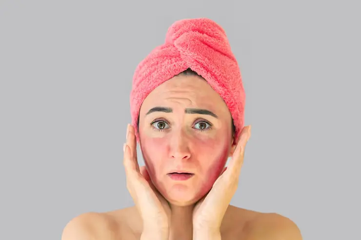 آیا فیشیال و پاکسازی پوست عوارض دارد؟