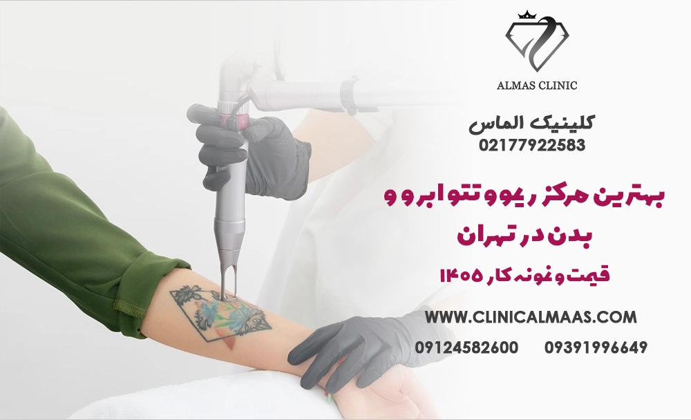 بهترین مرکز ریموو تتو ابرو و بدن در تهران + قیمت و نمونه کار 1405