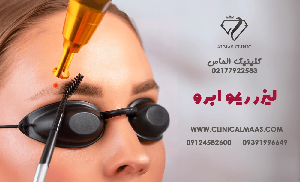 لیزر ریمو ابرو؛ راهنمای کامل پاک کردن تاتو، هاشور، فیبروز و میکروبلیدینگ ابرو