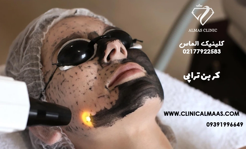 کربن تراپی 
