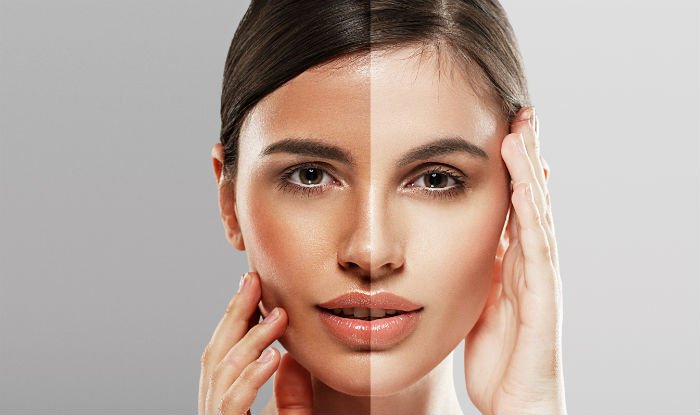 وایتنینگ صورت چیست؟ + روشن سازی پوست در بهترین کلینیک تهران 
