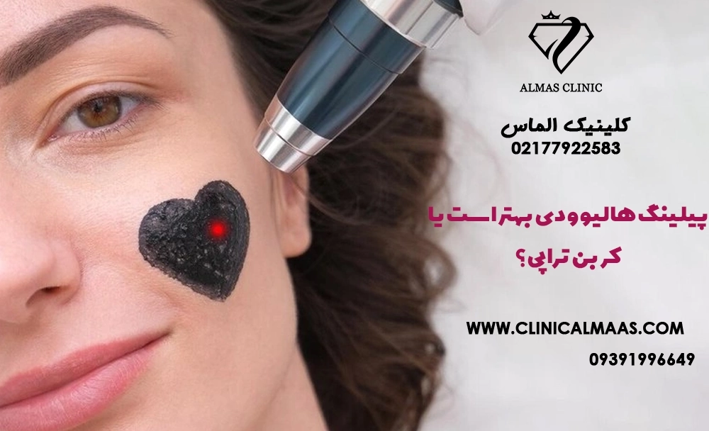 پیلینگ هالیوودی بهتر است یا کربن تراپی؟ مقایسه کامل برای لک، جوش، منافذ و شفافیت پوست