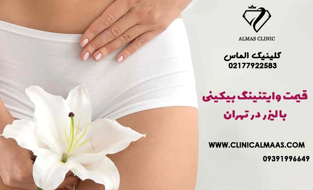 قیمت وایتنینگ بیکینی با لیزر در تهران؛ هزینه، تعداد جلسات و ماندگاری