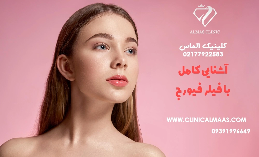 آشنایی کامل با فیلر فیورج