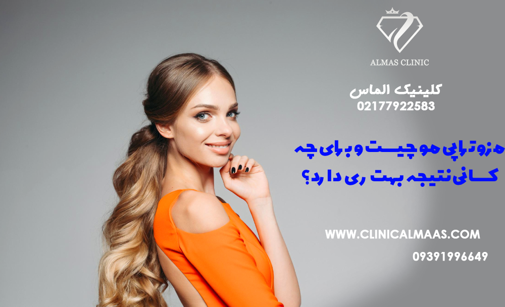 مزوتراپی مو چیست و برای چه کسانی نتیجه بهتری دارد؟