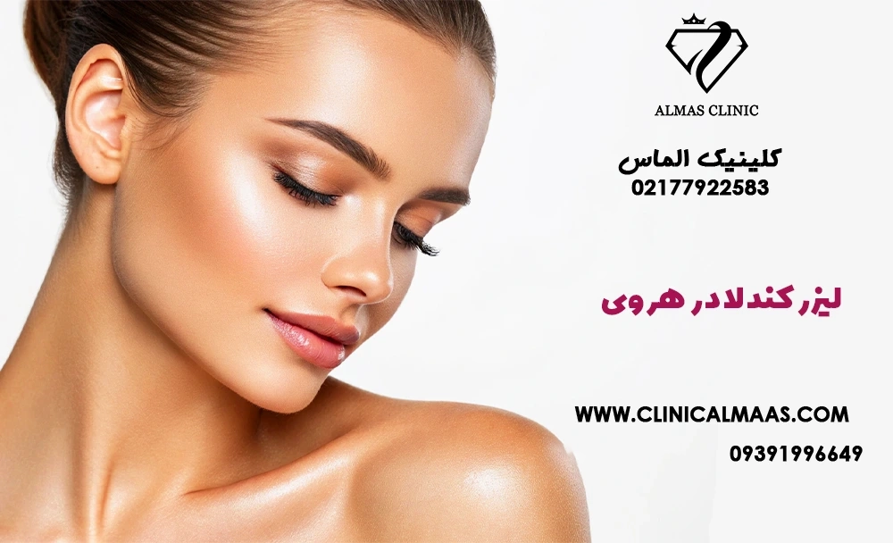 لیزر کندلا در هروی