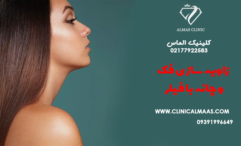 زاویه‌سازی فک و چانه با فیلر یا نخ؟ ماندگاری و ریسک‌ها