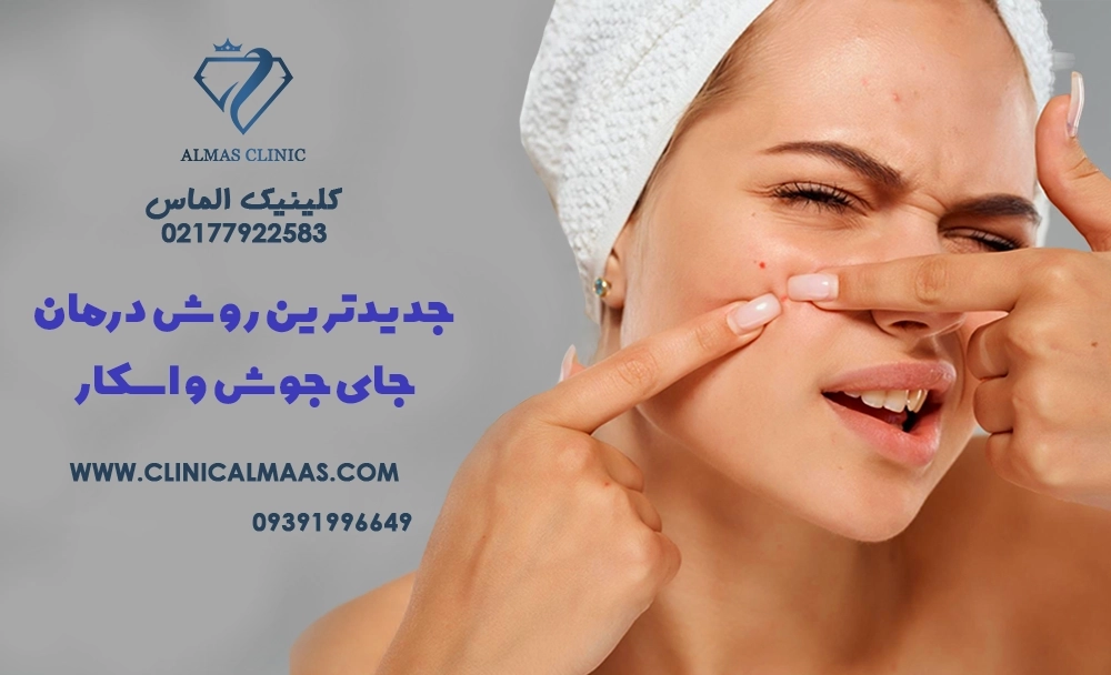 جدیدترین روش‌های درمان جای جوش و اسکار