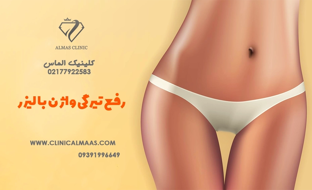 رفع تیرگی واژن با لیزر