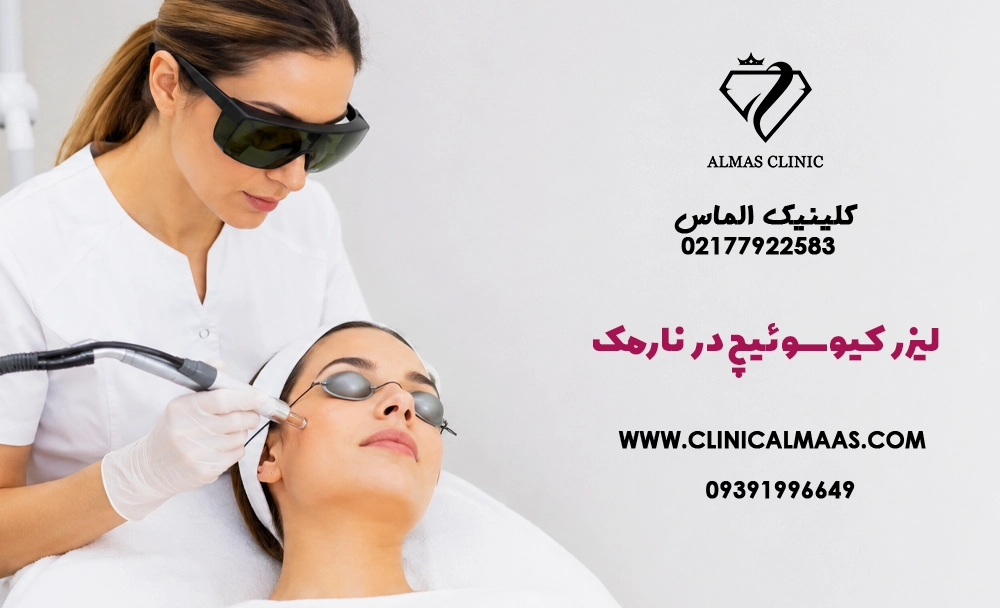 لیزر کیوسوئیچ در نارمک