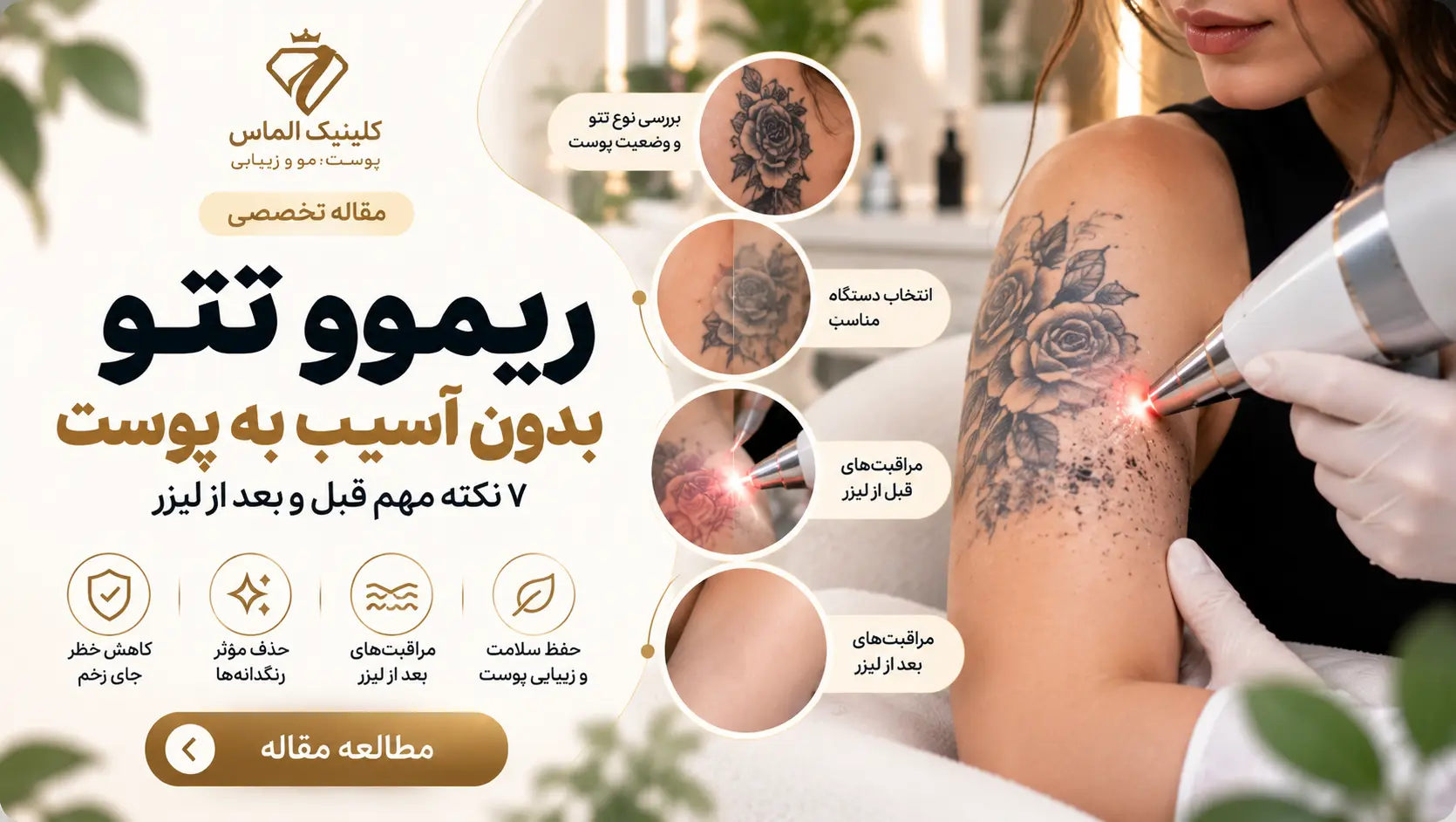 ریموو تتو بدون آسیب به پوست؛ ۷ نکته مهم قبل و بعد از لیزر