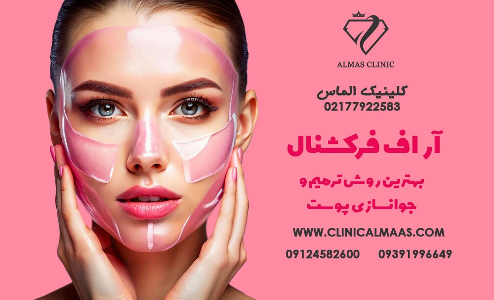 آر اف فرکشنال : بهترین روش ترمیم و جوانسازی پوست | کلینیک زیبایی الماس شرق تهران | اسفند 1403