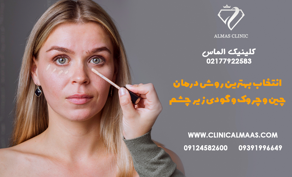 انتخاب بهترین روش برای درمان چین و چروک‌ها، خطوط لبخند و گودی زیر چشم