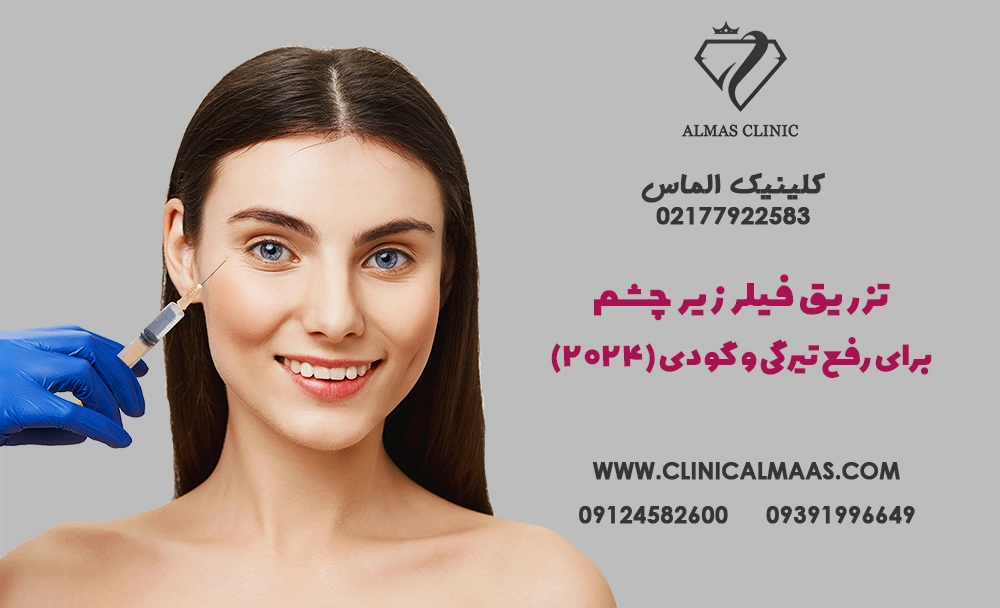 تزریق فیلر زیر چشم برای رفع تیرگی و گودی (2024)