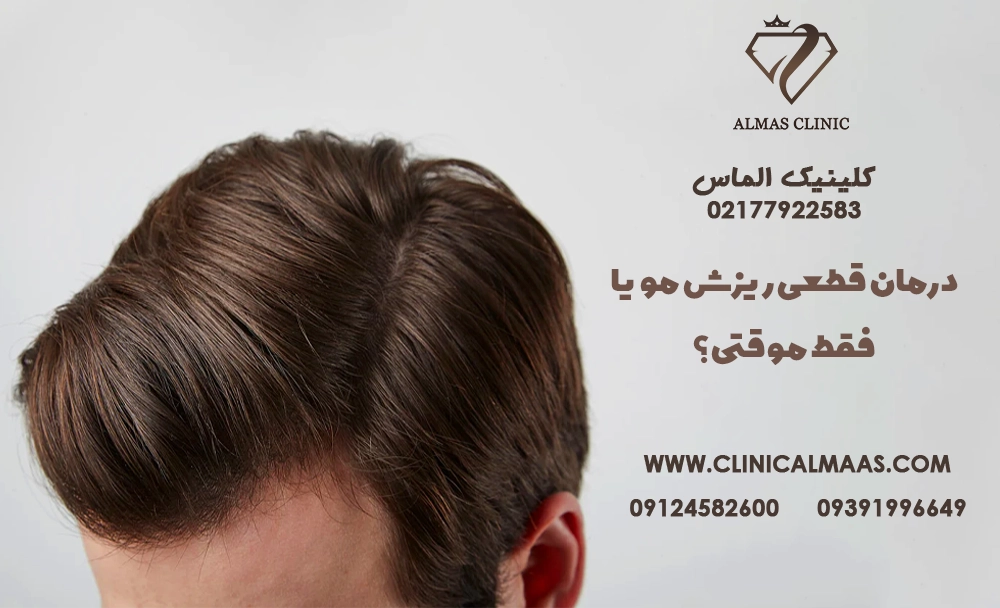 درمان قطعی ریزش مو یا فقط موقتی؟