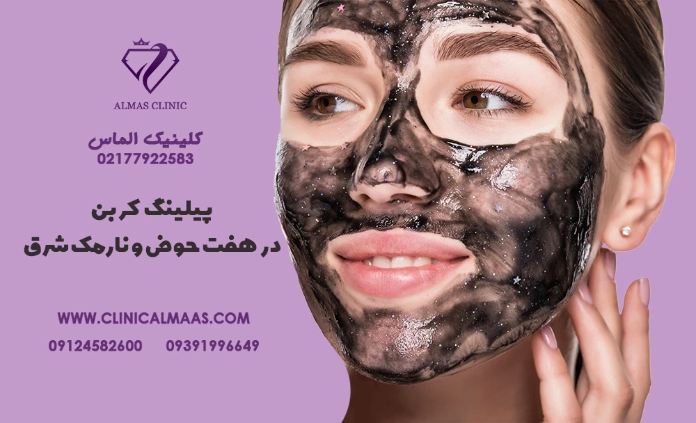 پیلینگ کربن در هفت حوض نارمک شرق